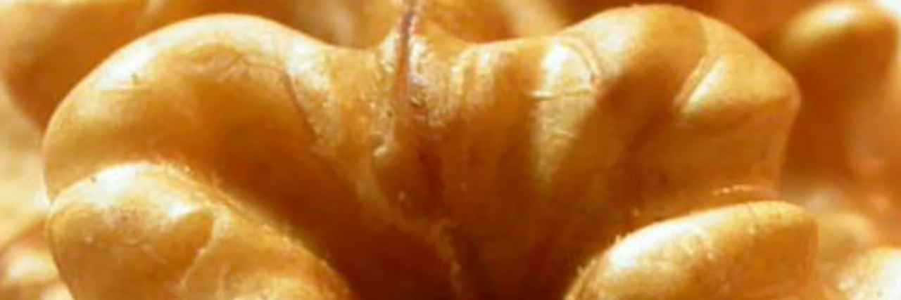 Seeing Disability From a New Perspective Mystery image.