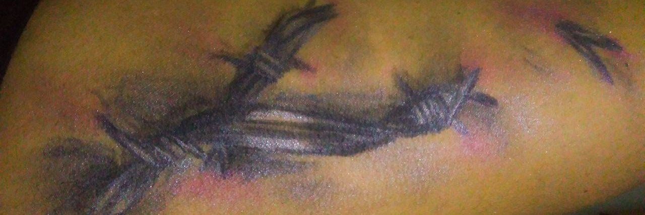 What Different Types of Fibromyalgia Pain Feel Like woman drawing types of pain on her leg