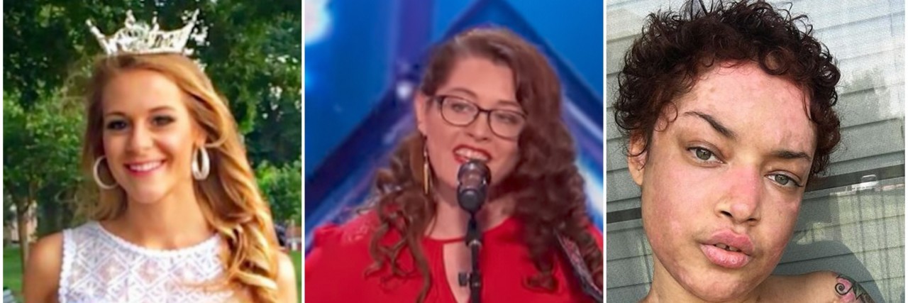 11 People Who Changed the Perception of Chronic Illness in 2017 victoria graham, mandy harvey and jokiva bellard