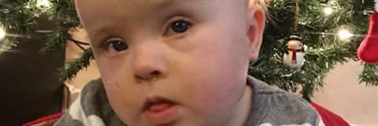 Processing a Down Syndrome Diagnosis