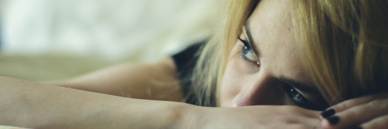 Accepting My Chronic Fatigue Syndrome Relapse A woman resting her head on her hands.