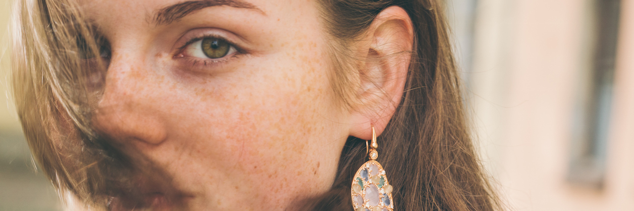 When People Say, 'You Don't Look Like You Have an Eating Disorder' Beautiful woman face portrait freckles street city fashion nature