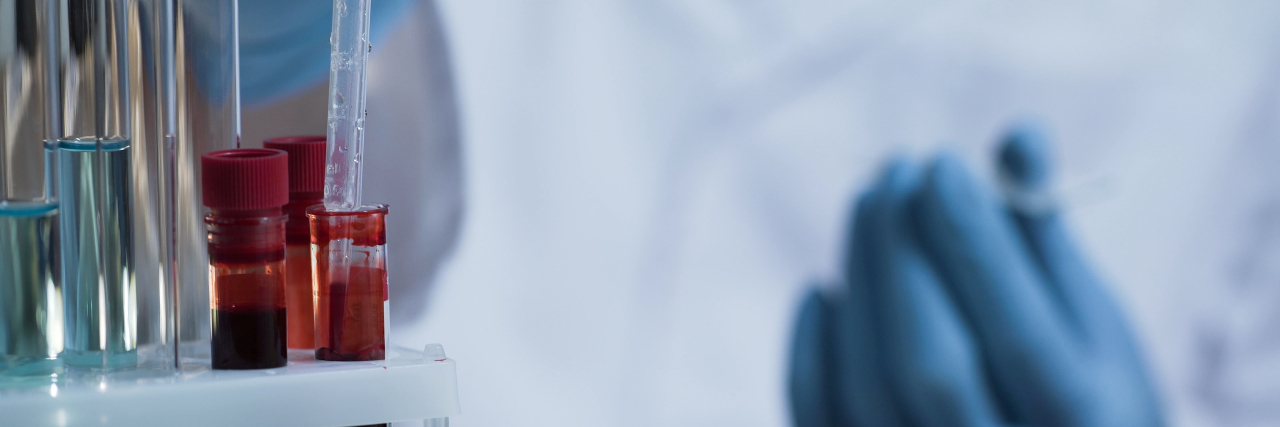 UK Research Team Develops Blood Test to Detect Multiple Sclerosis scientist taking blood sample for medical testing