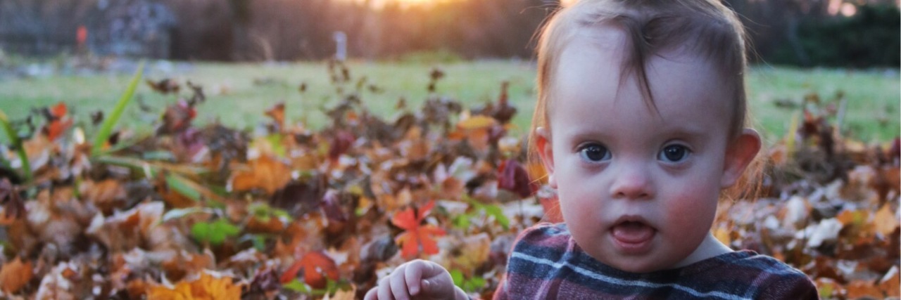 Our Prenatal Diagnosis of Down Syndrome Was Somehow Unusual Beautiful girl with down syndrome