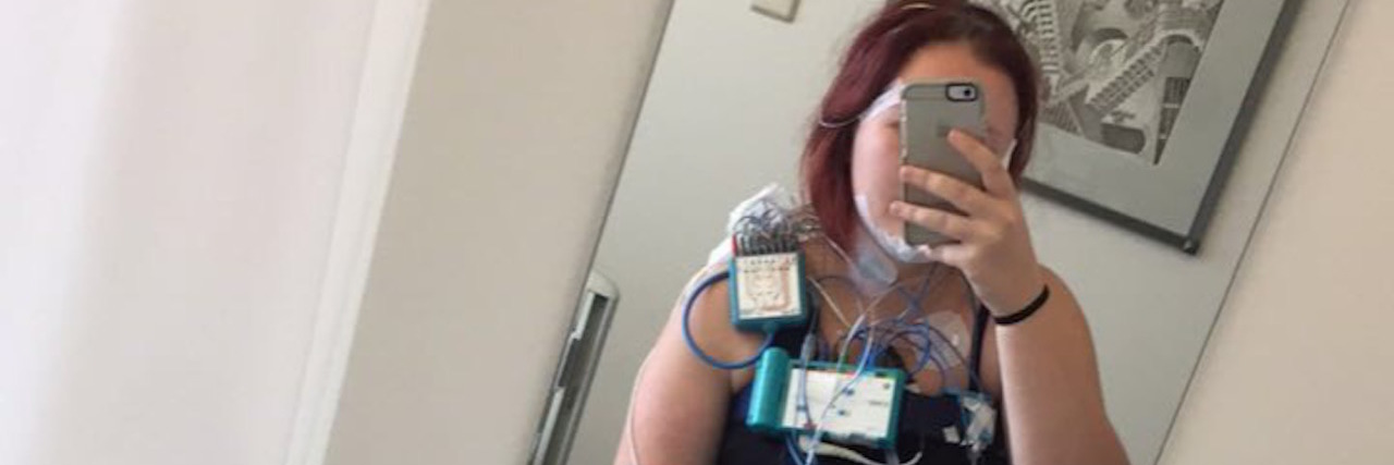 Why Narcolepsy Makes Me Feel So Fatigued The writer with medical equipment on her.