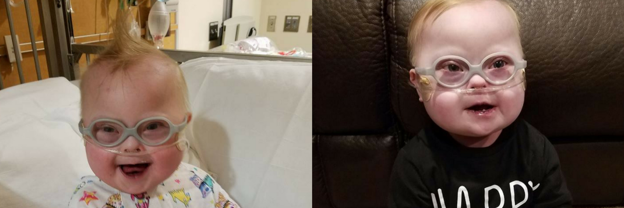 Baby With Down Syndrome Colton Murray Dies Colton Murray