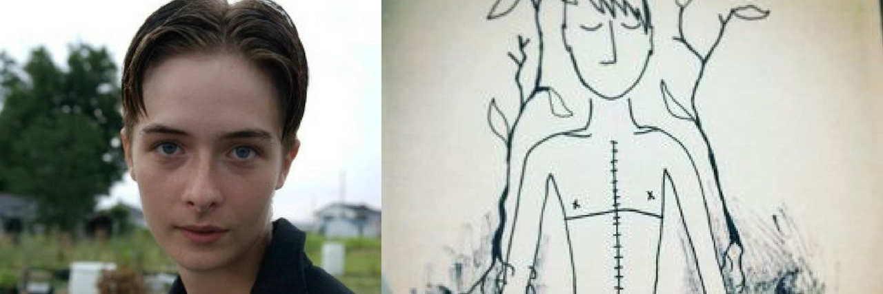 How Chronic Fatigue Syndrome Changed Me for the Better photo of the author next to a drawing of a man