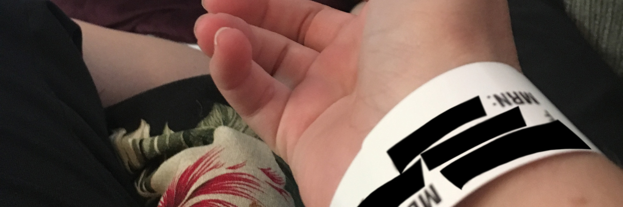 Getting Through the Days With Lupus When Life Just Sucks woman wearing hospital bracelet