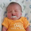 baby boy with cleft lip