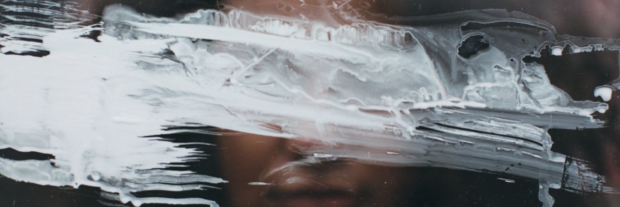 Why It Hurts to Be Called 'Childish' For Struggling With Mental Health woman blurred face