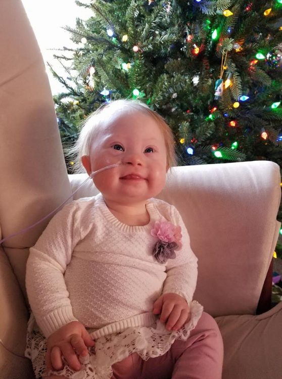 Baby with Down syndrome sitting on a pale pink sofa chair, she wear a white shirt and has a feeding tube in her nose