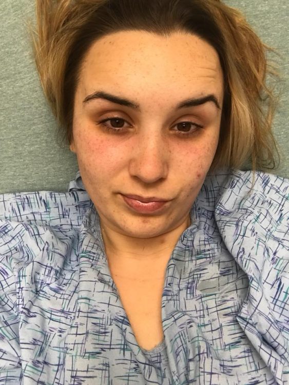 woman taking a selfie wearing a hospital gown