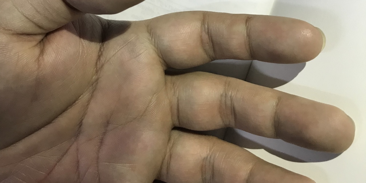What My Partner's Bleeding Hand Taught Us About Pain