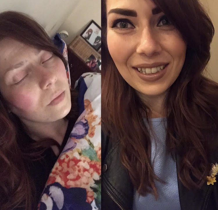 side by side comparison photos of a woman on the same day. in the photo on the left, she's not wearing makeup and is lying in bed under a floral blanket with her eyes closed. in the photo on the right, she is dressed up, wearing makeup and smiling.