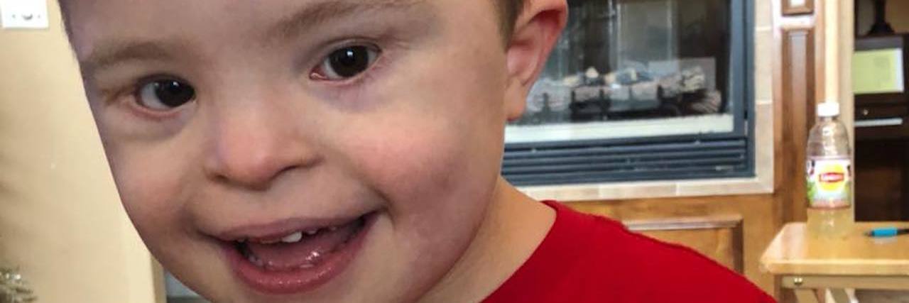 What You Might Want to Know About My Son With Down Syndrome