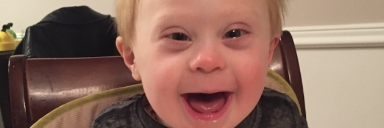 When People Use the R-Word Baby boy with Down syndrome sitting on his high chair and smiling at the camera