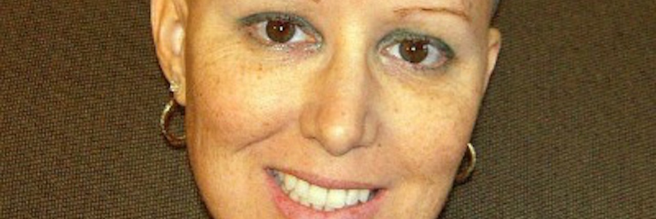 10 Reasons I Found the Good in Losing My Hair During Chemo breast cancer survivor with bald head