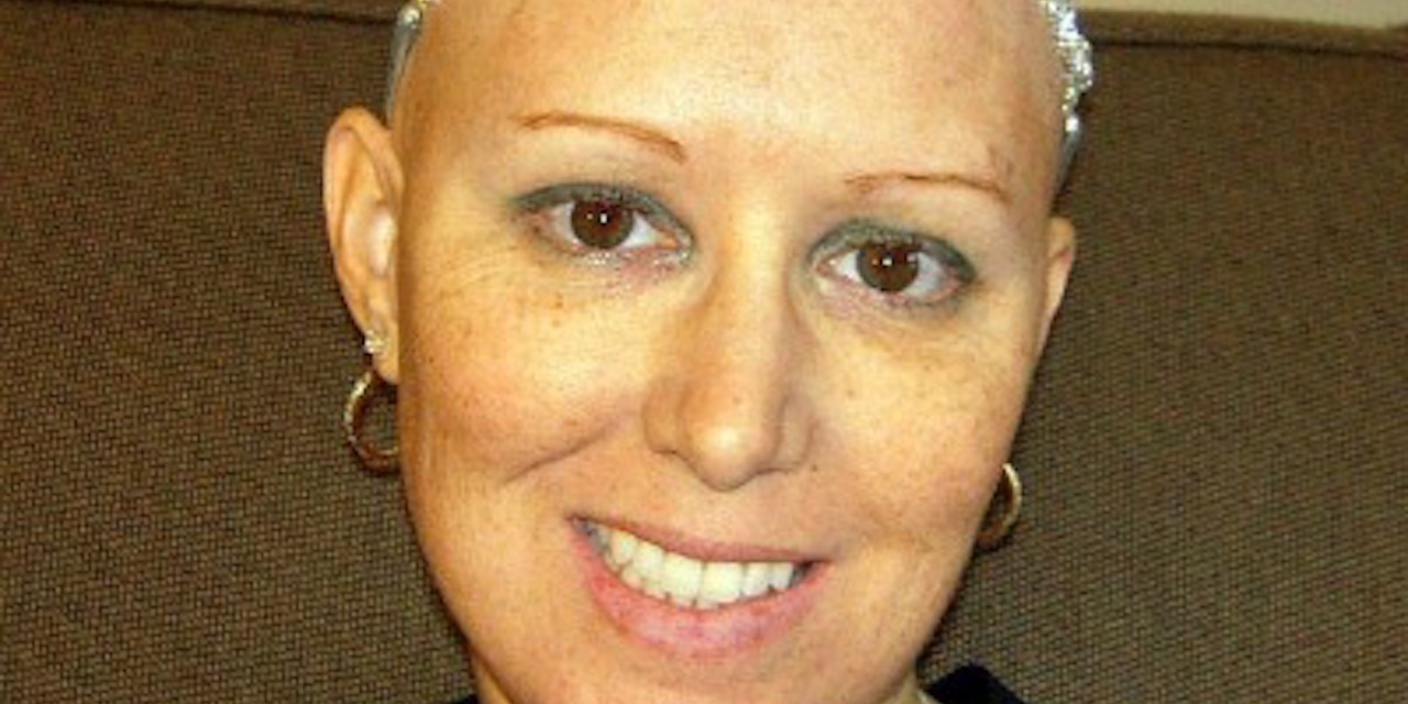 10 Reasons I Found the Good in Losing My Hair During Chemo