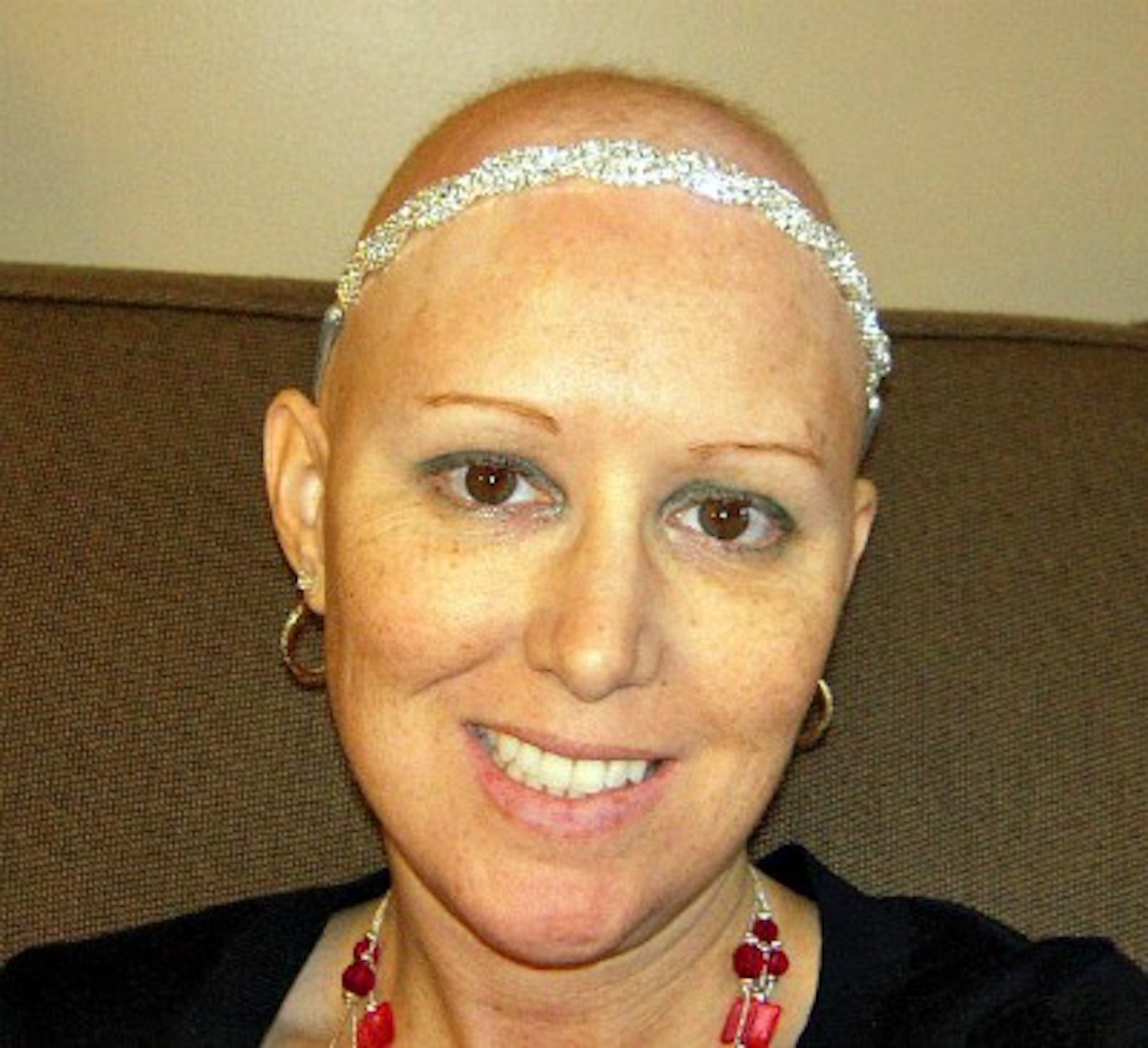breast cancer survivor with bald head