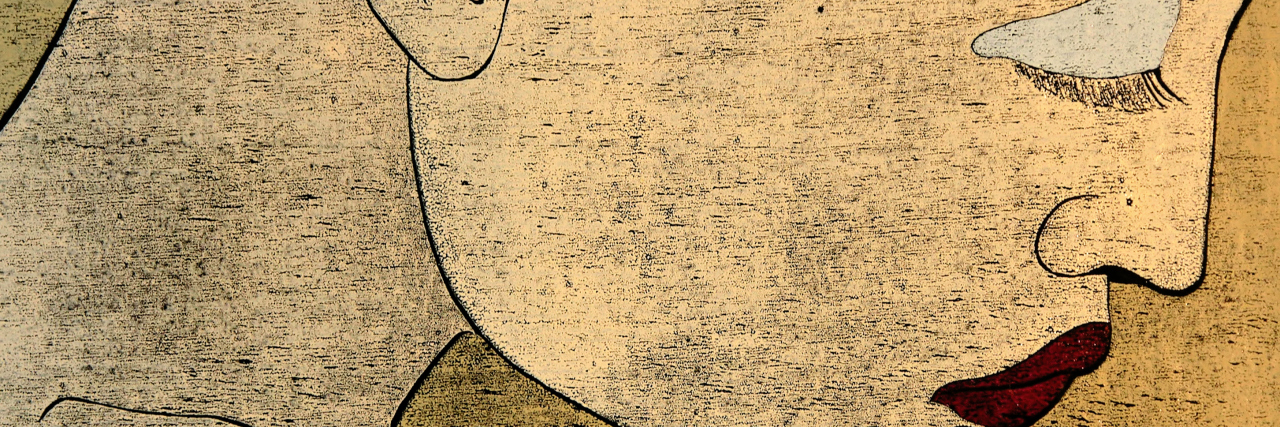 Looking Healthy and Living With CRPS Woodprint technique on black paper of a sad, thinking woman's portrait depicting feminine fragility.