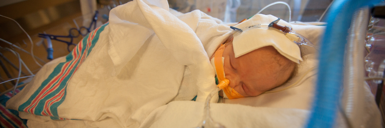 How To Survive Your Child's Open-Heart Surgery