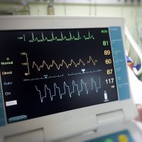 Close up EKG monitor in ICU room.
