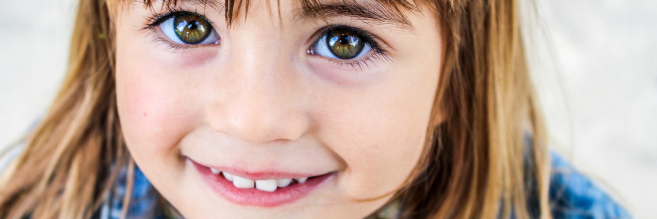 How My Daughter Responded to My Psoriasis Outbreak Photo of a 3-year-old girl.