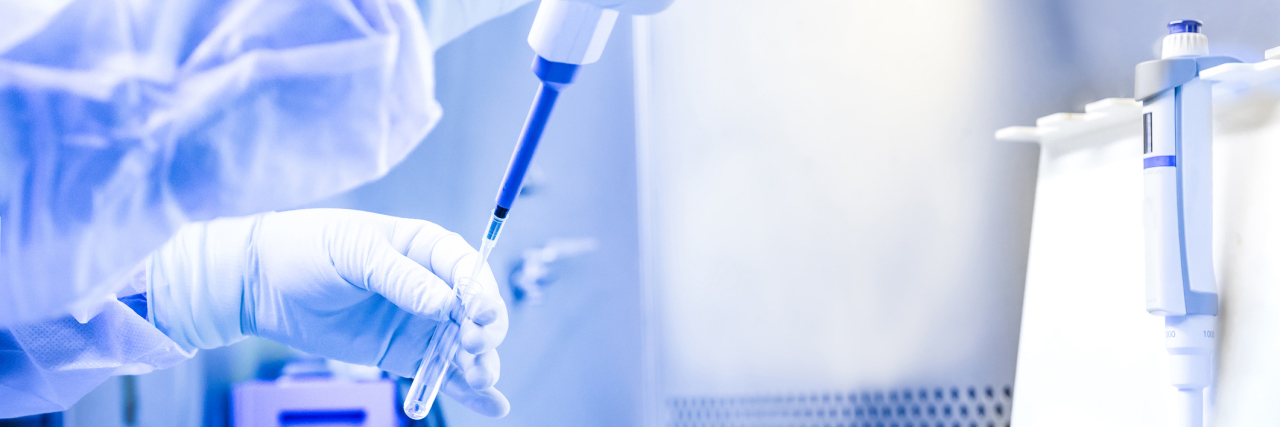 Study Shows One Possible Reason More Women Have Lupus Than Men scientist in lab