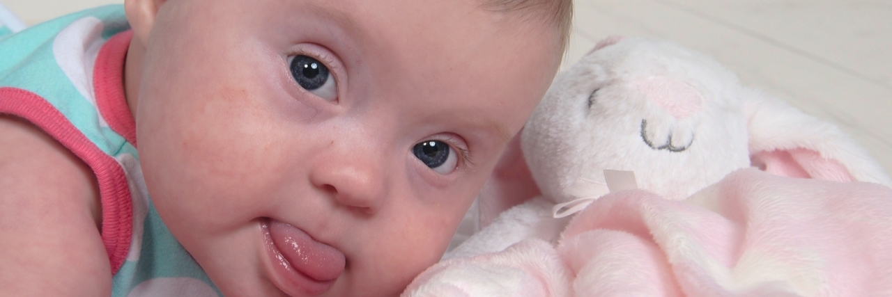 Baby girls with Down syndrome laying on her stomach, close up, looking a camera and her tongue is sticking out
