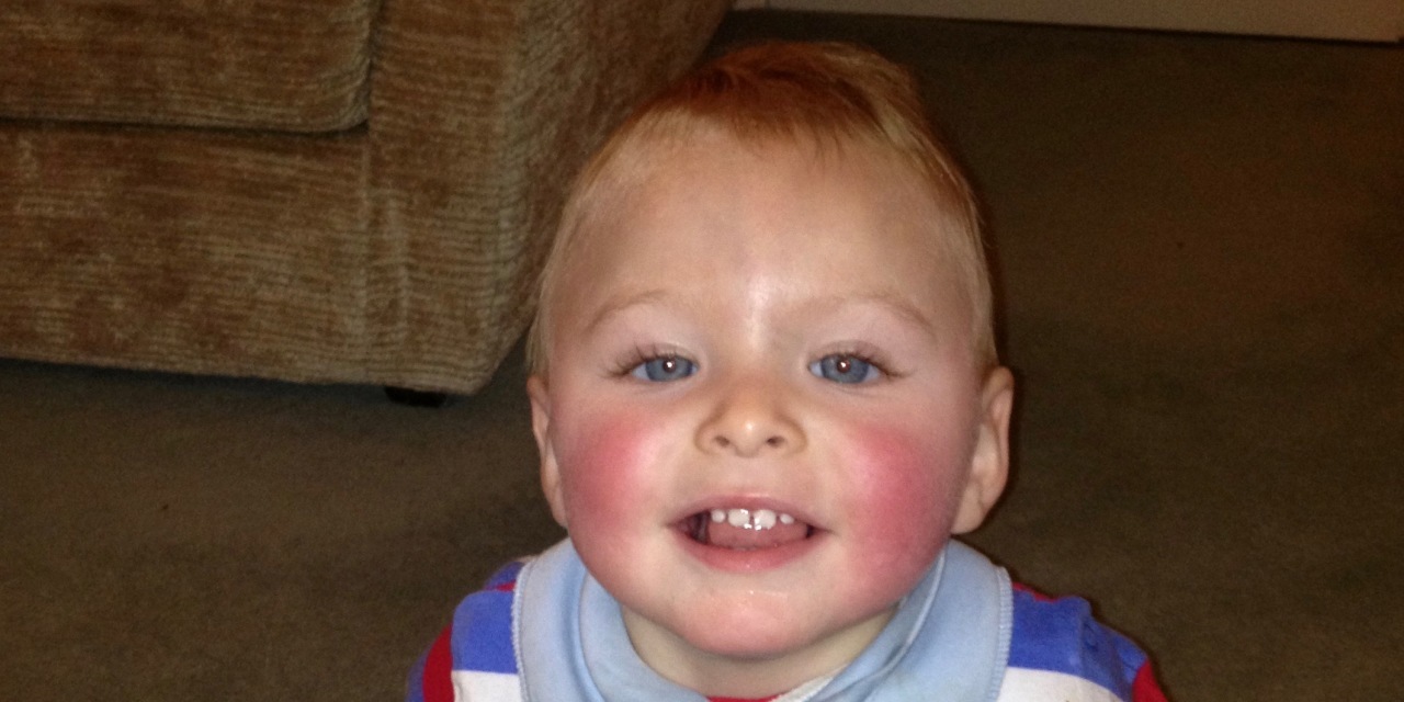 Receiving a TUBA 1A Diagnosis For Your Child