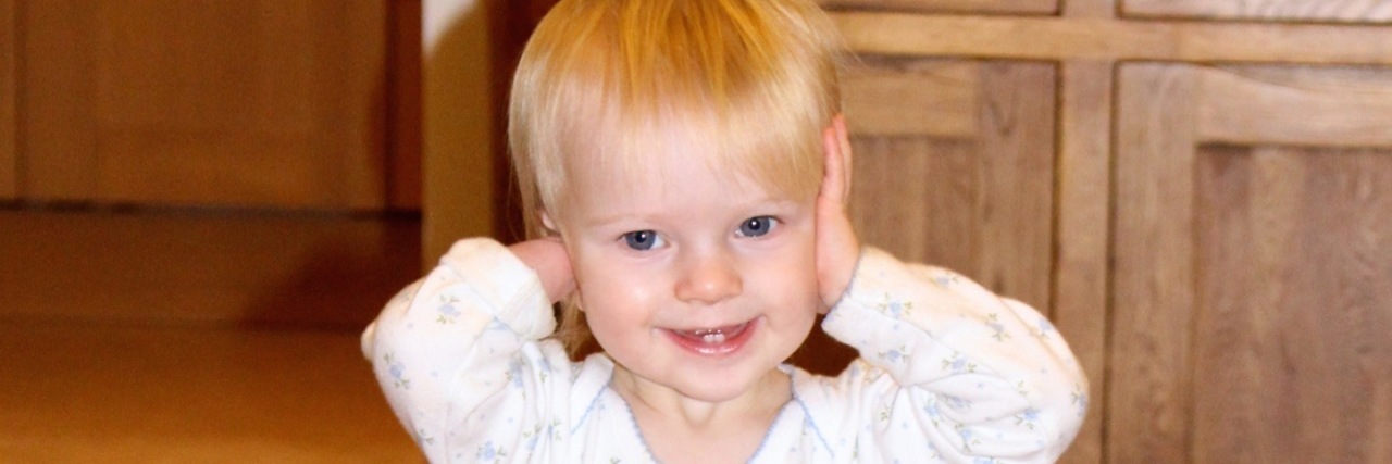 Please Understand I Celebrate My Daughter's Limb Difference Little girl covering her ears, one of her hands is missing, which mom refers to as "nubbins"