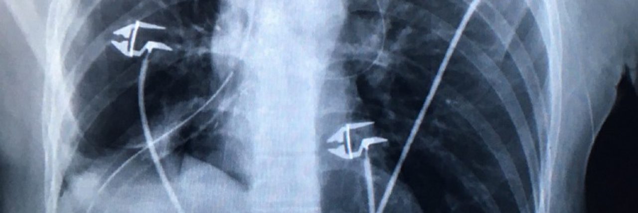 On Breathing Oana Stanescu X Ray photo