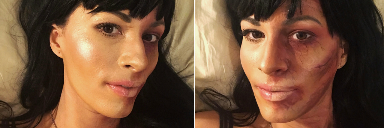 Making My Invisible Illness Visible Through Makeup woman wearing makeup with one half of her face looking healthy and the other half looking sick