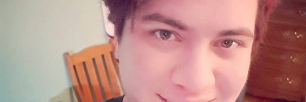 How Transitioning From Female to Male Saved This 23-Year-Old From Skin Cancer Emmett Paul selfie