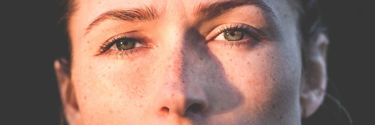 How OCD and a Phobia Almost Took My Life woman with freckles and gap in teeth looks straight at the camera