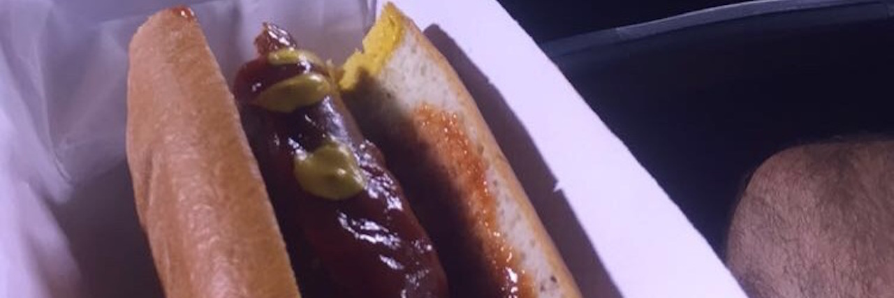7 Things I Love About Having Celiac Disease hot dog