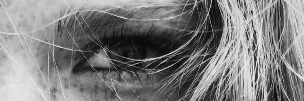 3 Things I Want People to Know About Helping an Adult Who Self-Harms woman eye