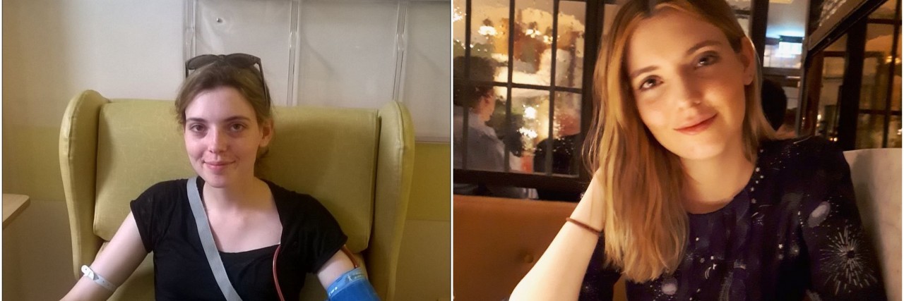 Woman Refused Help at Stansted Airport for Not Looking 'Disabled' two photos of nathalie allport-grantham