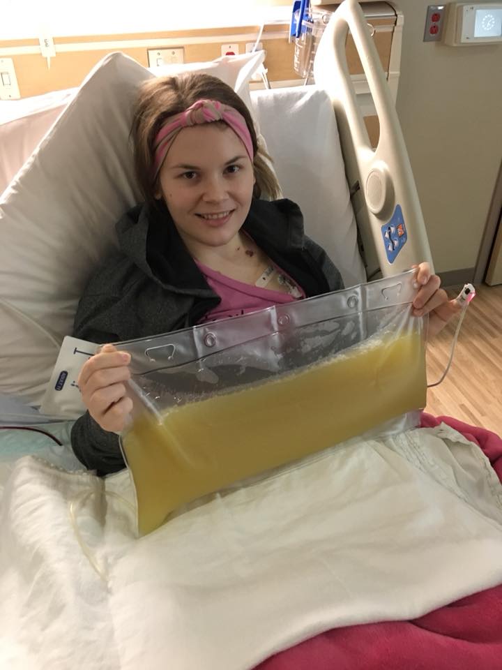 woman lying in a hospital bed holding a large bag of plasma