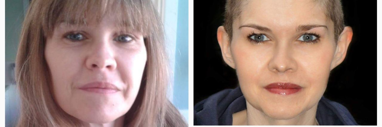 Why I Cut My Hair to Help With My Chronic Fatigue Syndrome photo of woman with long hair and bangs, and two photos of her with a buzz cut