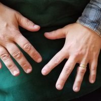 overhead view of hands with tardive dyskinesia