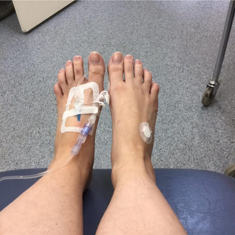 foot with IV in vein