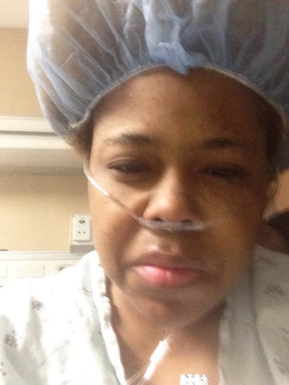 woman in the hospital wearing a hair net, oxygen tube and hospital gown