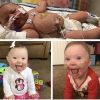 Photo collage. 1. Post open-heart surgery. 2. Smiling baby sitting on floor and tongue out. 3. Smiling baby with stickers for ng-tube on cheeks.