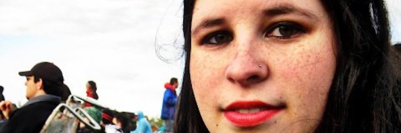 Losing My Hair After a Brain Tumor and Regaining Self-Esteem woman with long black hair