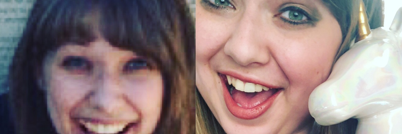 Learning to Accept the Side Effects of Prednisone