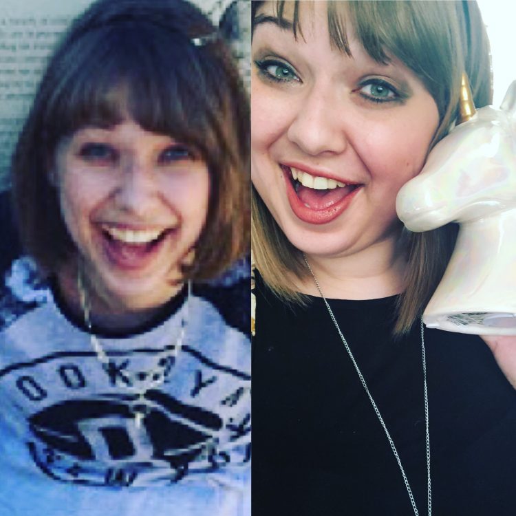 side by side photos of the author before and after prednisone