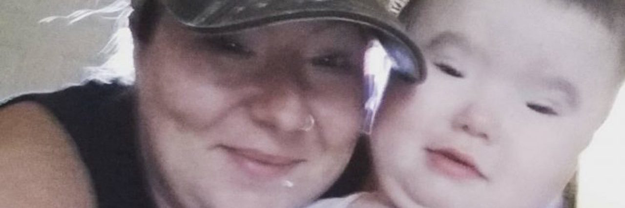 Experiencing Bullying Because of Your Rare Disease the author with her nephew who has BPES