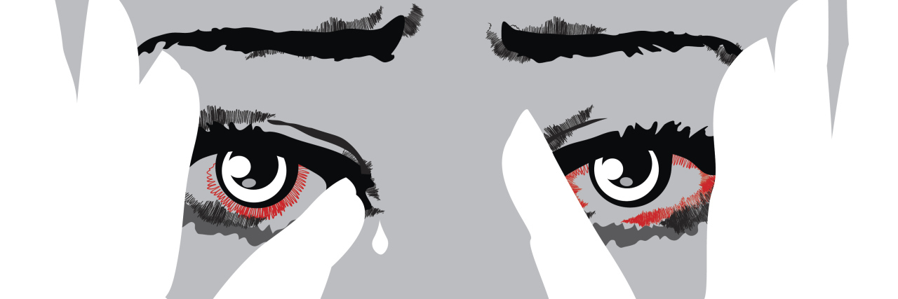 What It's Like to Be Mocked for Your Disability Unhappy woman cries covering face with hands.