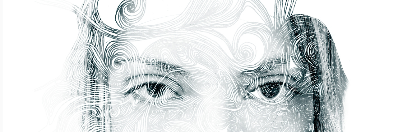 Learning to Appreciate Scars With Amniotic Band Syndrome portrait of a woman's face